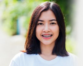 Orthodontics Improves the Appearance of Your Teeth and Smile by Correcting Imperfections